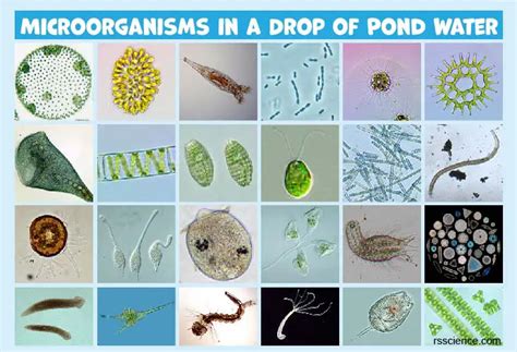  Reticulomyxa: Can This Tiny Blob Conquer Your Microscopic World?