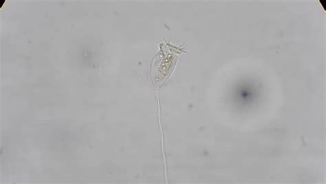  Vorticella! An Amazing Single-Celled Creature Living a Suspended Life