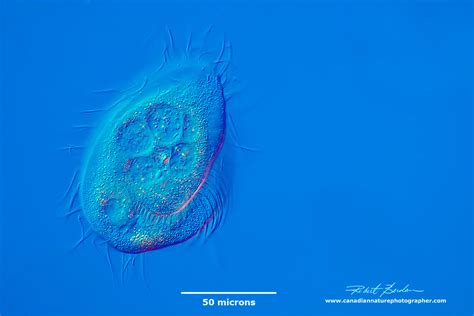  Johnstoniella! This Tiny Ciliate Holds the Secrets to Freshwater Survival